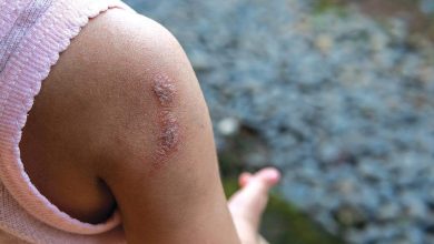 Photo of ΕΟΔΥ : Στρεπτοκοκκική λοίμωξη: μπορεί να οδηγήσει σε ξαφνικό θάνατο